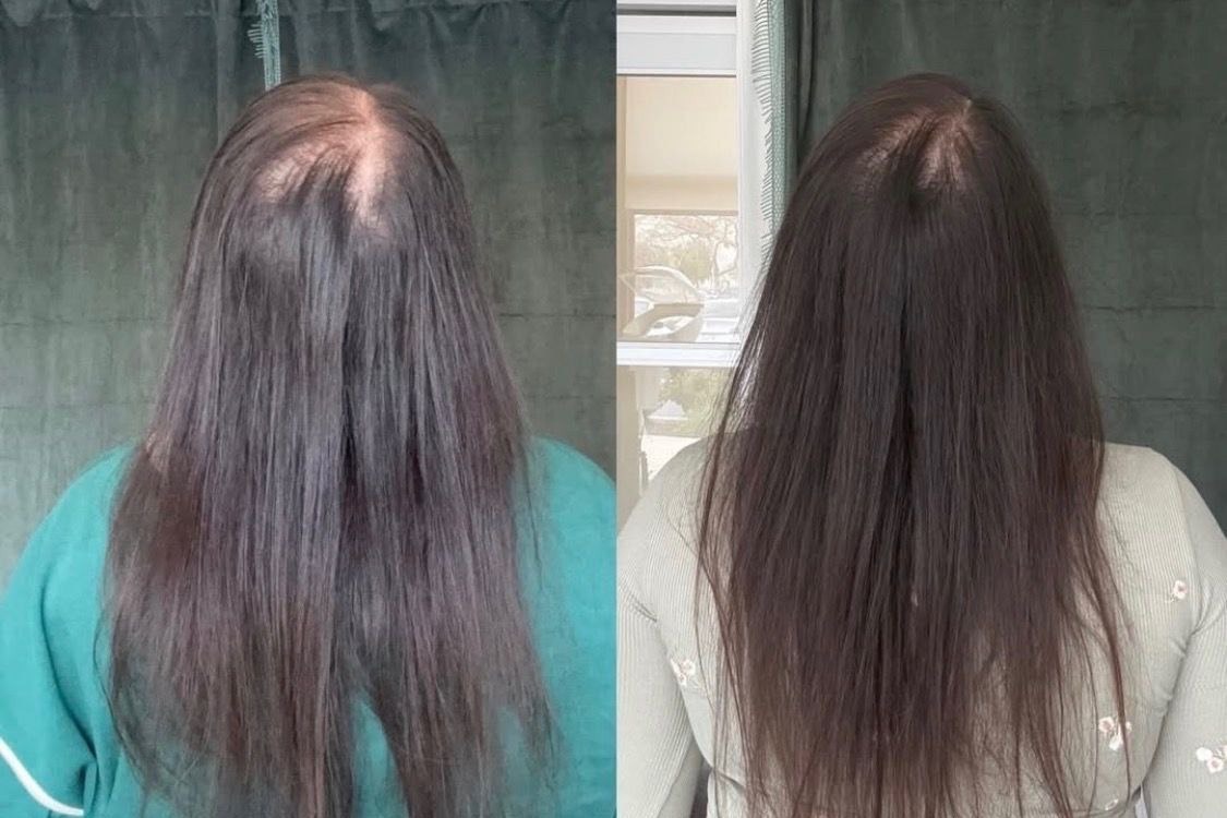 Before and After — back view
